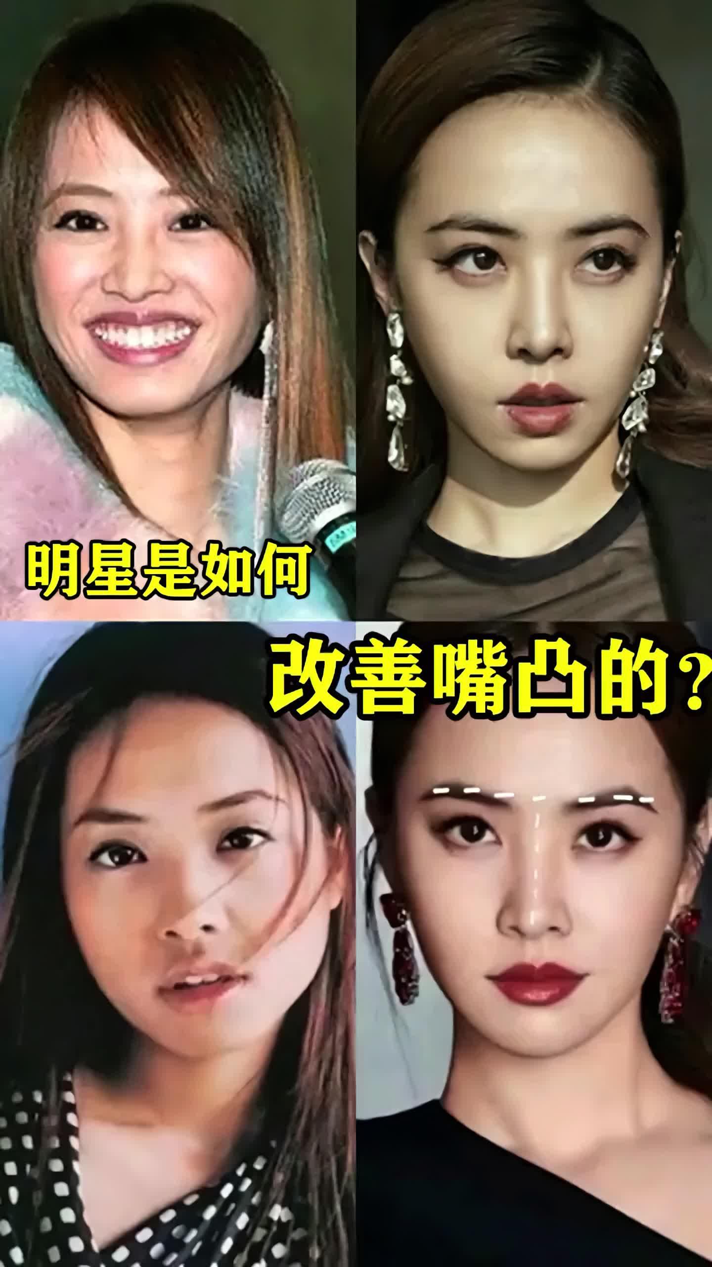 蔡依林改变了龅牙凸嘴后妥妥的一代女神