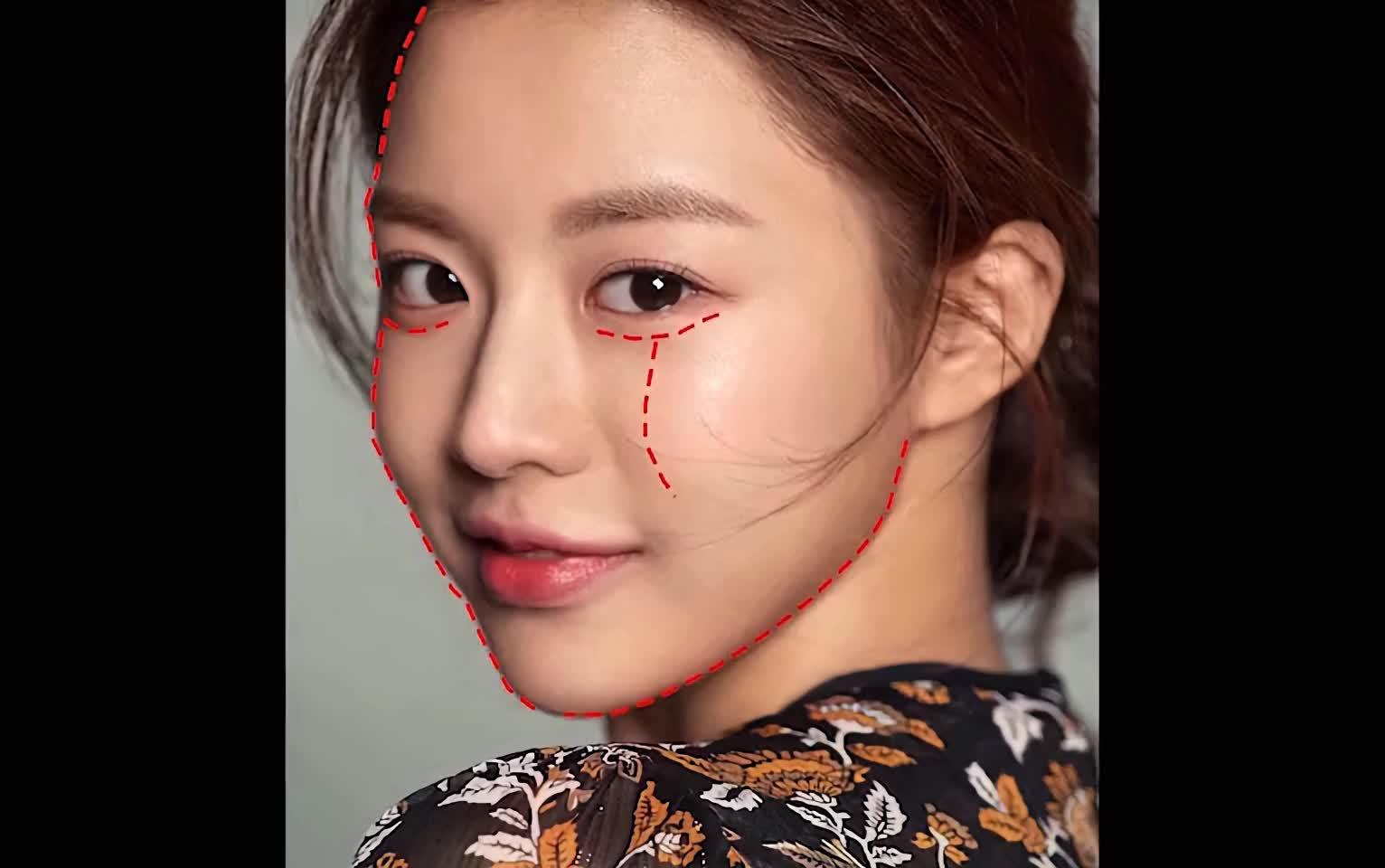 你知道哈姆单凸曲线是什么吗?#出圈吧!医生!_圈子-新氧美容整形